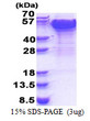 SDS-PAGE of recombinant human Dynactin Subunit 2 DCTN2 protein under reducing conditions