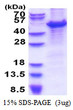 SDS-PAGE gel of recombinant human MCM7 protein under reducing conditions