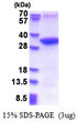 MMADHC recombinant protein SDS-PAGE gel 3µg reducing conditions Coomassie stain