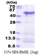 SDS-PAGE gel of recombinant human CCDC69 protein under reducing conditions Coomassie blue stain