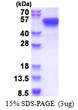 SDS-PAGE gel of recombinant human KRT16 protein 3µg reducing conditions Coomassie stain