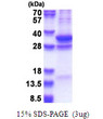 SDS-PAGE gel of recombinant human COPS7A protein under reducing conditions