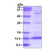 SDS-PAGE gel of recombinant human PF4V1 CXCL4L1 protein under reducing conditions