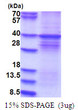 SDS-PAGE of recombinant rat DYRK1A protein under reducing conditions stained with Coomassie blue
