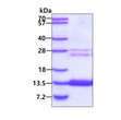 SDS-PAGE gel of recombinant human COMMD6 protein 3μg under reducing conditions Coomassie blue stain