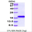 SDS-PAGE gel of recombinant human IL-36Ra IL36RN protein under reducing conditions