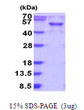 SDS-PAGE gel of recombinant human RAB3IL protein under reducing conditions Coomassie blue stain