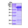 SDS-PAGE gel of recombinant human NMT1 protein under reducing conditions stained with Coomassie blue