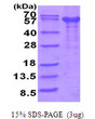 SDS-PAGE gel of recombinant human IL-12R beta IL12RB1 protein under reducing conditions