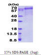 SDS-PAGE of recombinant human FARSB protein under reducing conditions stained with Coomassie blue