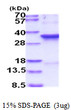 SDS-PAGE gel of recombinant human CDK1 protein stained with Coomassie blue