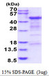 SDS-PAGE of recombinant human CD4 protein under reducing conditions Coomassie blue stain