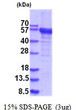 SDS-PAGE gel showing 3µg recombinant human RNMTL1 protein under reducing conditions Coomassie blue stain