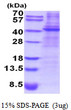 SDS-PAGE gel of recombinant human Decorin protein STJP019141 under reducing conditions Coomassie blue stain