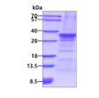 SDS-PAGE gel of recombinant human Slug protein stained with Coomassie blue
