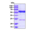 SDS-PAGE gel of recombinant human ALDH6A1 protein stained with Coomassie blue