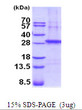 SDS-PAGE gel of recombinant human beta-Sarcoglycan SGCB protein under reducing conditions