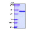 SDS-PAGE gel of recombinant human NMNAT-1 protein under reducing conditions Coomassie blue stain