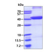 SDS-PAGE gel of recombinant human FBPase 1 protein stained with Coomassie blue