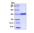 SDS-PAGE gel showing recombinant E. coli carbonic anhydrase 2 CA2 protein 3 μg under reducing conditions Coomassie blue stain
