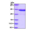 SDS-PAGE of recombinant human HNMT protein under reducing conditions stained with Coomassie blue