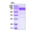 SDS-PAGE of recombinant human Angiopoietin 2 ANGPT2 protein under reducing conditions