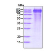 SDS-PAGE gel of recombinant SARS-CoV-2 spike S1 subunit protein under reducing conditions