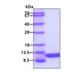 SDS-PAGE of recombinant human Resistin RETN protein under reducing conditions with Coomassie blue stain