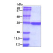 SDS-PAGE gel of recombinant human Casein kinase 2 beta protein under reducing conditions