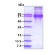 SDS-PAGE of recombinant human NKp80 KLRF1 protein under reducing conditions