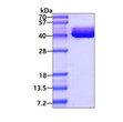 SDS-PAGE gel of recombinant human BAFF R TNFRSF13C protein under reducing conditions