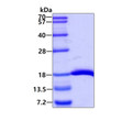 SDS-PAGE gel of recombinant E.coli DnaK 385-546aa protein stained with Coomassie blue
