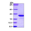SDS-PAGE of recombinant human FGF-12 protein under reducing conditions Coomassie blue stain