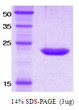 SDS-PAGE gel of recombinant human CD158i KIR2DS4 protein under reducing conditions