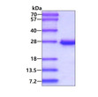 SDS-PAGE gel of recombinant human MGMT protein 3 μg under reducing conditions Coomassie blue stain