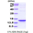 SDS-PAGE of recombinant human IPP-POZ 1-157aa protein under reducing conditions stained with Coomassie blue
