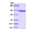 SDS-PAGE gel of recombinant human Cyclophilin E PPIE protein under reducing conditions