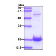 SDS-PAGE gel of recombinant human alpha-Synuclein A30P protein under reducing conditions Coomassie blue stain
