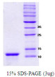 SDS-PAGE gel of recombinant human alpha-Synuclein 112 NACP112 protein under reducing conditions
