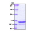 SDS-PAGE gel of recombinant human gamma-synuclein protein under reducing conditions stained with Coomassie blue