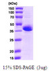 SDS-PAGE gel showing recombinant human STIM1 protein 3µg under reducing conditions Coomassie blue stain