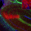 IHC staining RGS14 in rat brain CA2 hippocampal pyramidal neurons with GFAP co-stain STJA0040441