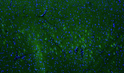 IHC staining rat brain cerebral cortex with anti-LRRK2 antibody green and DAPI blue STJA0040460