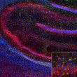 IHC staining rat hippocampus with anti-Parvalbumin antibody GABAergic interneurons STJA0040504