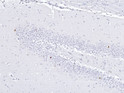 IHC staining rat hippocampus with anti-c-FOS antibody neuronal nuclei STJA0040522