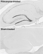 IHC staining rat hippocampus using anti-c-Fos antibody in seizure vs control tissue STJA0040522