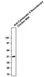 Western blot anti-Cytokeratin 8 antibody detection at 52 kDa in HeLa cell lysates STJA0040552