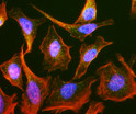 ICC staining HeLa cells with anti-Rab9 antibody late endosomes in green with DAPI STJA0040564