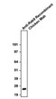 Western blot Rab9 chicken monoclonal antibody detection at 23 kDa in HeLa cell lysates STJA0040564