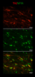 IHC staining mouse midbrain dopamine neurons TH red and NFYA green STJA0040570
